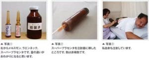 super placenta